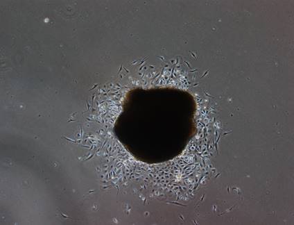 Keratinocytes growing from primary skin biopsy
